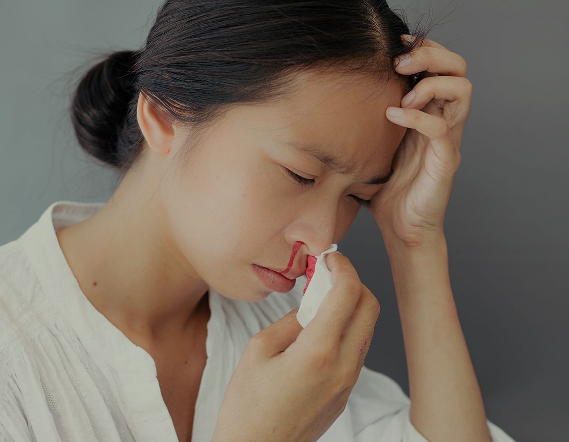 Epistaxis (Nosebleed)